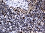 PCNA Antibody in Immunohistochemistry (Paraffin) (IHC (P))