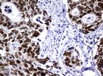 PCNA Antibody in Immunohistochemistry (Paraffin) (IHC (P))
