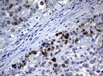 PCNA Antibody in Immunohistochemistry (Paraffin) (IHC (P))