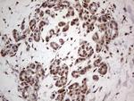 PCNA Antibody in Immunohistochemistry (Paraffin) (IHC (P))