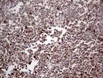 PCNA Antibody in Immunohistochemistry (Paraffin) (IHC (P))