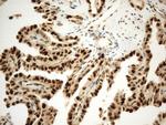 PCNA Antibody in Immunohistochemistry (Paraffin) (IHC (P))