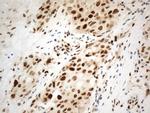 PCNA Antibody in Immunohistochemistry (Paraffin) (IHC (P))