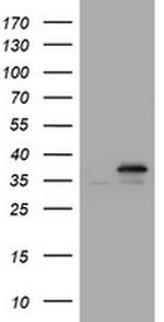 PCNA Antibody in Western Blot (WB)