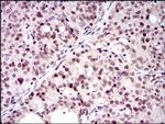 PCNA Antibody in Immunohistochemistry (Paraffin) (IHC (P))