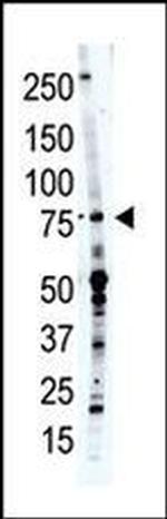 PCPTP1 Antibody in Western Blot (WB)