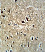 PCSK2 Antibody in Immunohistochemistry (IHC)