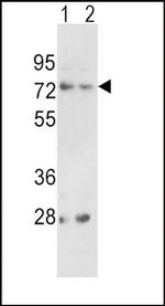 PCSK2 Antibody in Western Blot (WB)