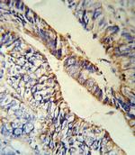 PCSK9 Antibody in Immunohistochemistry (IHC)