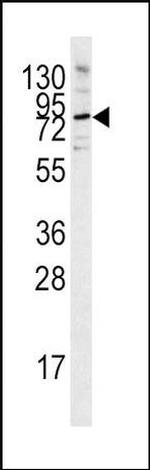 PCSK9 Antibody in Western Blot (WB)