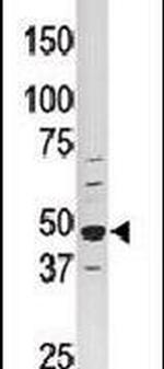 PCTAIRE1 Antibody in Western Blot (WB)