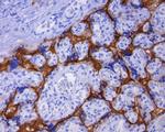 PD-L1 Antibody in Immunohistochemistry (Paraffin) (IHC (P))
