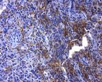 PD-L1 Antibody in Immunohistochemistry (Paraffin) (IHC (P))