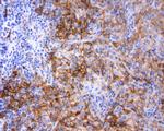 PD-L1 Antibody in Immunohistochemistry (Paraffin) (IHC (P))