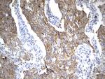 PD-L1 Antibody in Immunohistochemistry (Paraffin) (IHC (P))