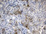 PD-L1 Antibody in Immunohistochemistry (Paraffin) (IHC (P))