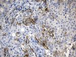 PD-L1 Antibody in Immunohistochemistry (Paraffin) (IHC (P))