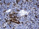 PD-L1 Antibody in Immunohistochemistry (Paraffin) (IHC (P))