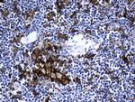 PD-L1 Antibody in Immunohistochemistry (Paraffin) (IHC (P))