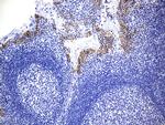 PD-L1 Antibody in Immunohistochemistry (Paraffin) (IHC (P))
