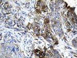 PD-L1 Antibody in Immunohistochemistry (Paraffin) (IHC (P))