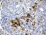 PD-L1 Antibody in Immunohistochemistry (Paraffin) (IHC (P))