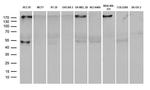 PD-L1 Antibody in Western Blot (WB)