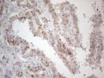 PD-L2 (PDCD1LG2) Antibody in Immunohistochemistry (Paraffin) (IHC (P))