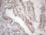 PD-L2 (PDCD1LG2) Antibody in Immunohistochemistry (Paraffin) (IHC (P))