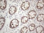 PD-L2 (PDCD1LG2) Antibody in Immunohistochemistry (Paraffin) (IHC (P))