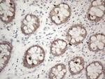 PD-L2 (PDCD1LG2) Antibody in Immunohistochemistry (Paraffin) (IHC (P))