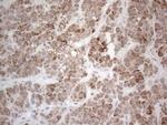 PD-L2 (PDCD1LG2) Antibody in Immunohistochemistry (Paraffin) (IHC (P))