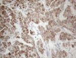 PD-L2 (PDCD1LG2) Antibody in Immunohistochemistry (Paraffin) (IHC (P))