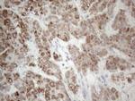 PD-L2 (PDCD1LG2) Antibody in Immunohistochemistry (Paraffin) (IHC (P))