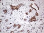 PD-L2 (PDCD1LG2) Antibody in Immunohistochemistry (Paraffin) (IHC (P))