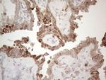 PD-L2 (PDCD1LG2) Antibody in Immunohistochemistry (Paraffin) (IHC (P))