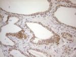 PD-L2 (PDCD1LG2) Antibody in Immunohistochemistry (Paraffin) (IHC (P))
