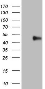 PD-L2 (PDCD1LG2) Antibody in Western Blot (WB)