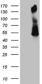 PD-L2 (PDCD1LG2) Antibody in Western Blot (WB)