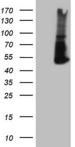 PD-L2 (PDCD1LG2) Antibody in Western Blot (WB)