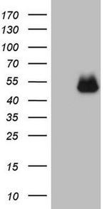 PD-L2 (PDCD1LG2) Antibody in Western Blot (WB)
