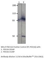 PDE11A Polyclonal Antibody