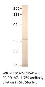 PDE1A7 Polyclonal Antibody