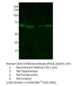 PDE1B Polyclonal Antibody