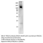 PDE2A Polyclonal Antibody