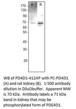 PDE4D1 Polyclonal Antibody