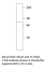 PDE9A Polyclonal Antibody