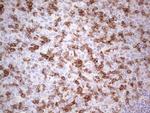 PDCD1 Antibody in Immunohistochemistry (Paraffin) (IHC (P))