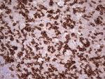 PDCD1 Antibody in Immunohistochemistry (Paraffin) (IHC (P))
