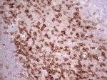 PDCD1 Antibody in Immunohistochemistry (Paraffin) (IHC (P))